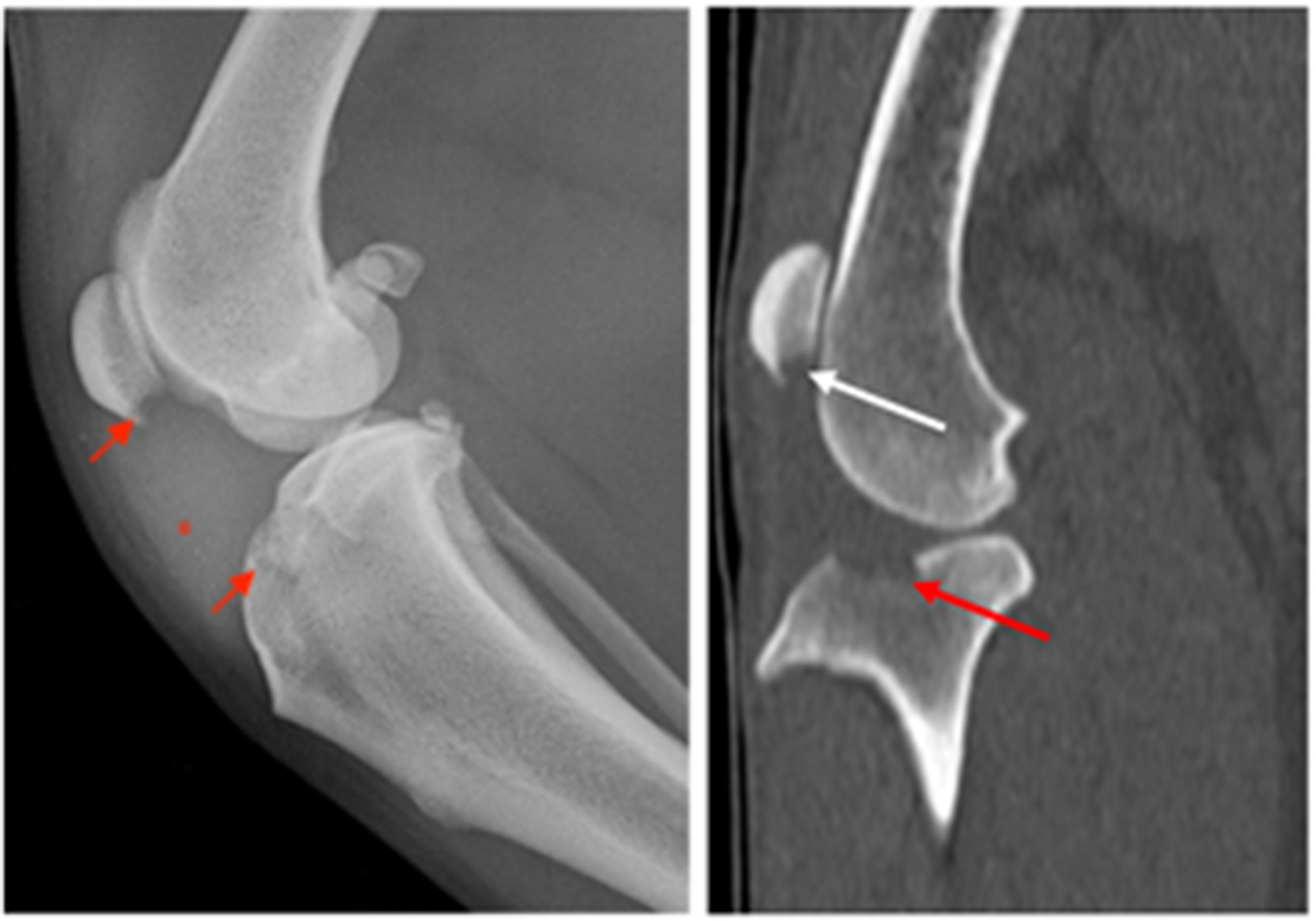 Tibial-Plateau-2-3.jpg