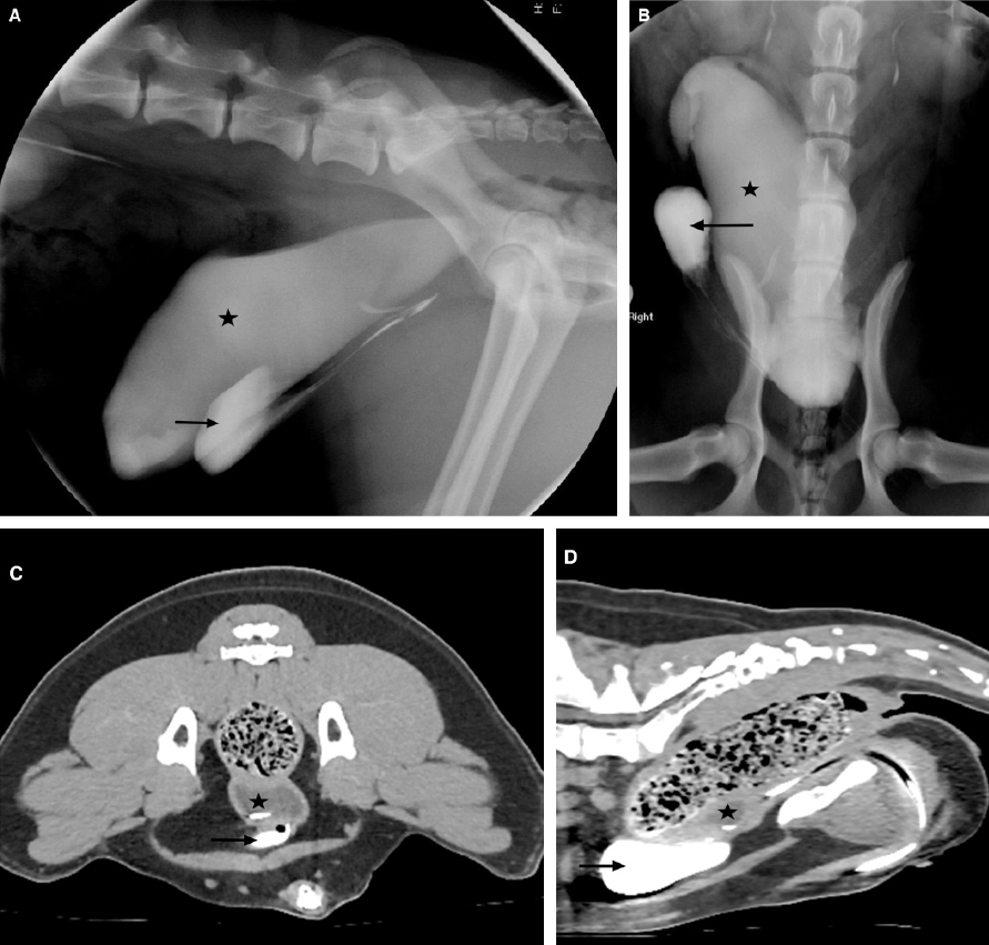 uterus.jpg