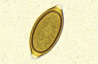 Zoetis'_VETSCAN_IMAGYST_Global_Trichuris_Parasite_Vertical_Fecal_Image.jpg