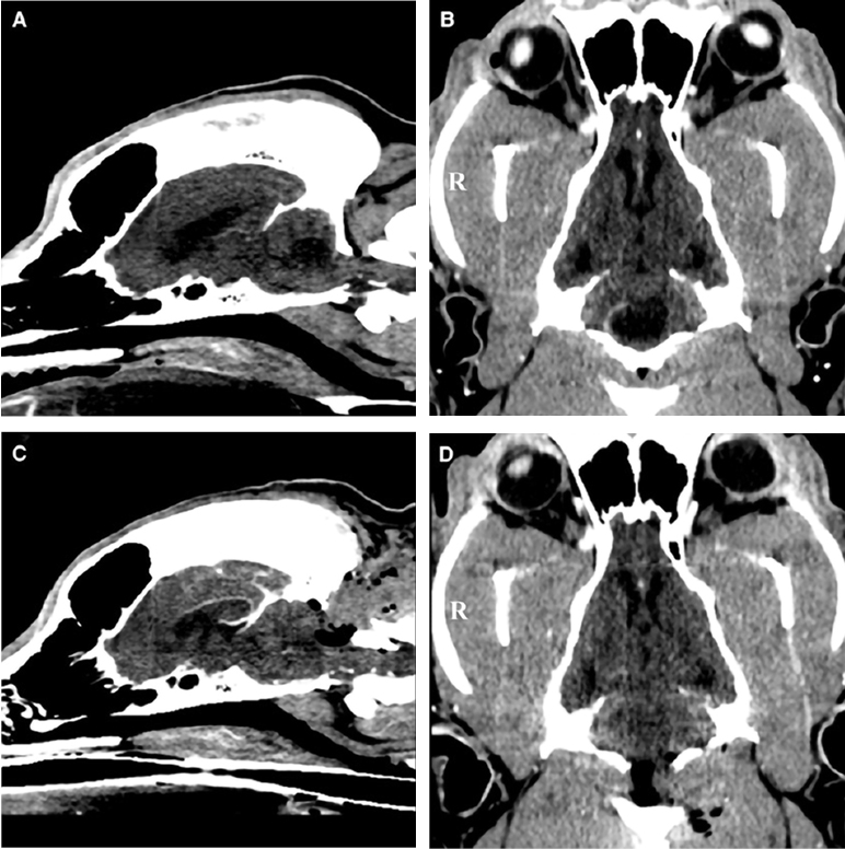 “MRI