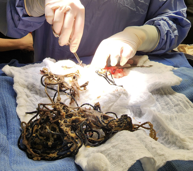 HAIR_TIES_AFTER_SURGERY.jpg