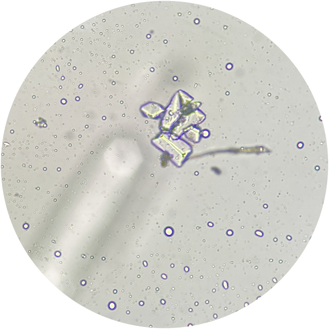 Microscopic view of struvite crystals