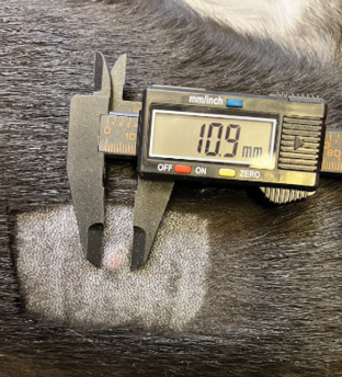 Measuring tumor using digital caliper