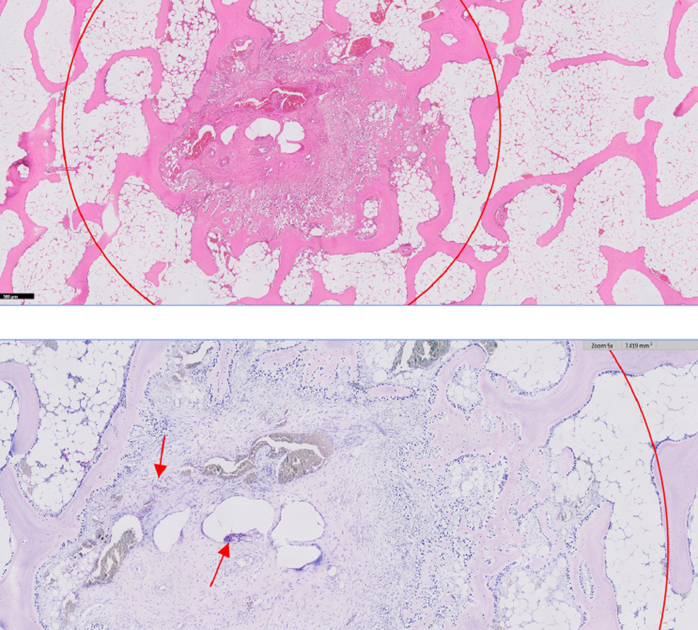 Tibial-Plateau.jpg