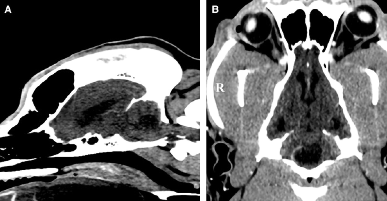 MRI images of a dog's brain with an ependymal cyst.