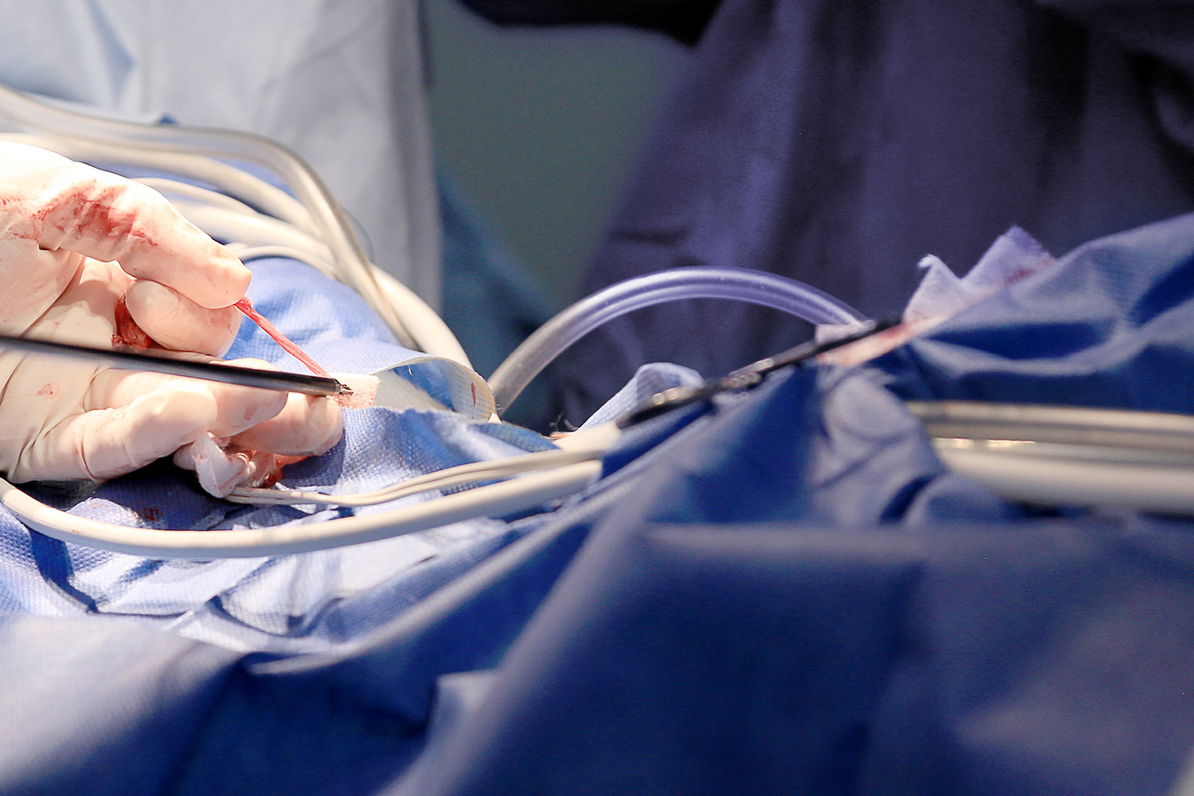 Closeup photo of a veterinarian using a laser during surgery