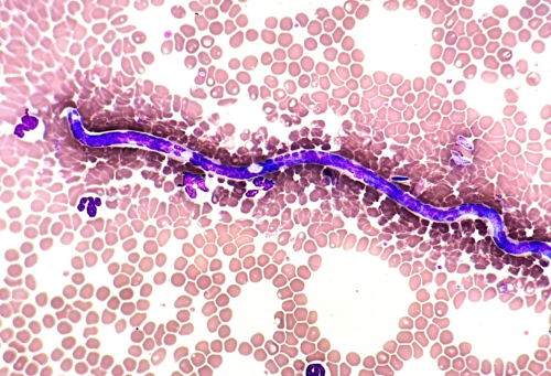 heartworm