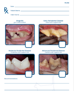 Dental graphical aid showing stages of periodontal disease