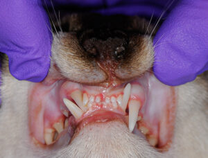 Image showing a Malpositioned (mesioverted) right maxillary canine