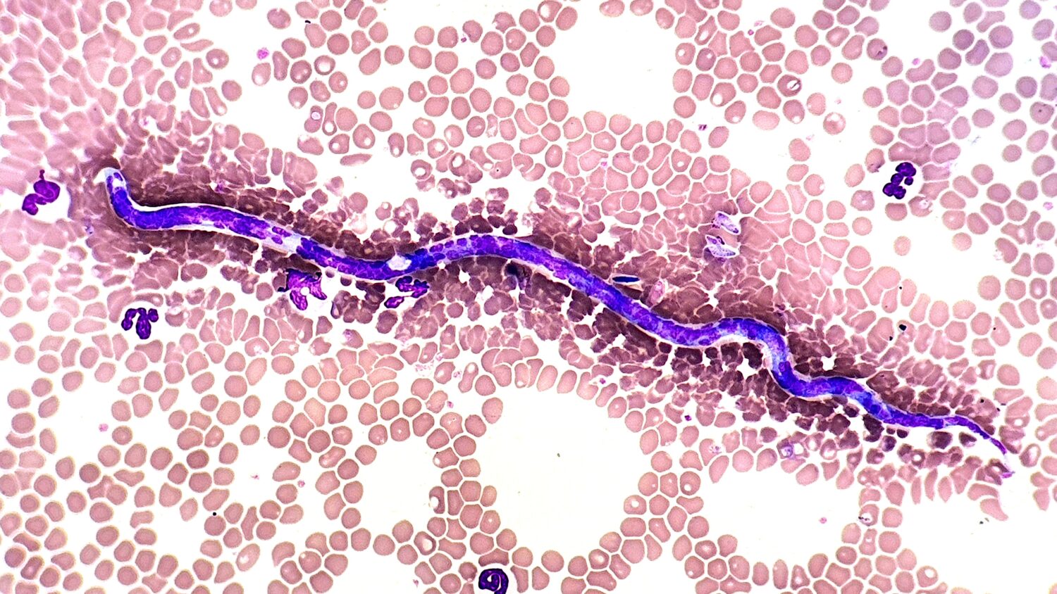 Dirofilaria in dog blood under microscope (40x Objective) with Wright's stain
